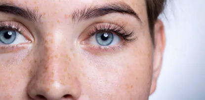 laser eye surgery cost