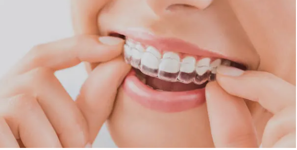 Invisalign Adelaide